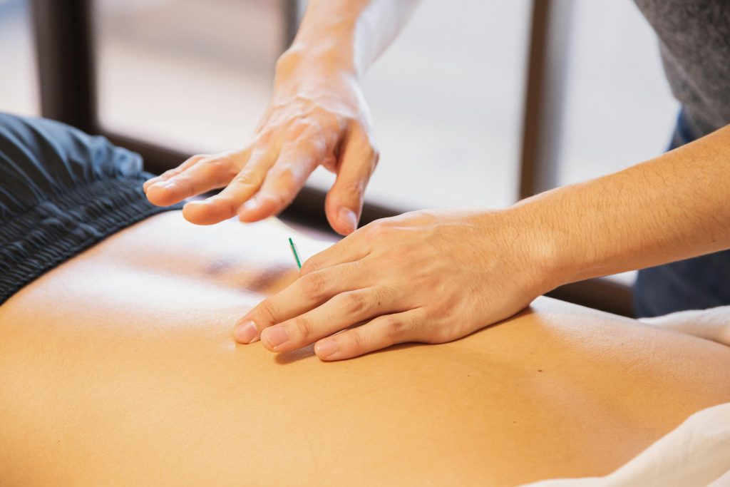 Dry Needling